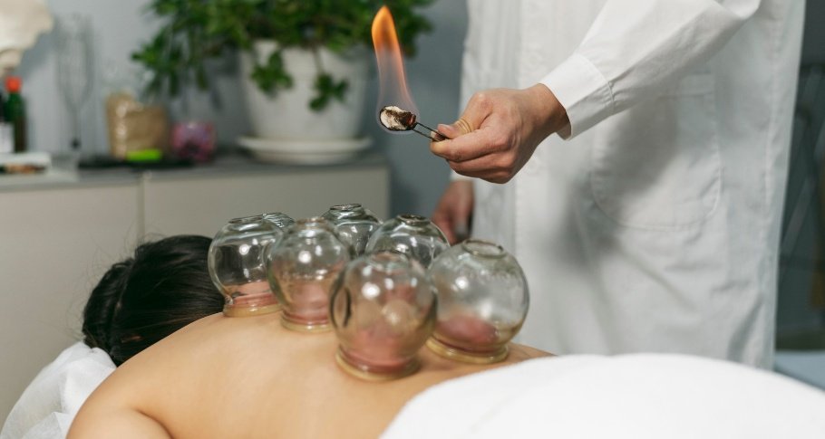 Marketing Tips For Cupping Therapy Clinics